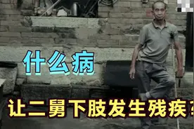 被二舅的视频刷屏了！什么病，让二舅下肢残疾？医生说出自己看法视频封面
