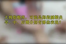 大拇指根疼，可能是拇指腱鞘炎，早、中、后期分别有哪些表现？视频封面