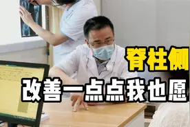 女子患脊柱侧弯强烈希望手术，患者：即使改善一点点我也愿意视频封面