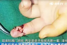 吓人！姐弟玩推门游戏，两岁弟弟手指被夹断一截，鲜血直流！视频封面