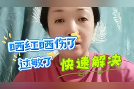 夏天皮肤晒红晒伤了，紫外线过敏了！这招能帮你快速镇敏退红消热视频封面