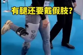 31. 明明腿还在为什么要穿戴假肢 '视频封面