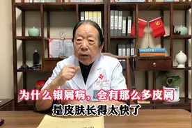 为什么银屑病 会有那么多皮屑 是皮肤长得太快了视频封面