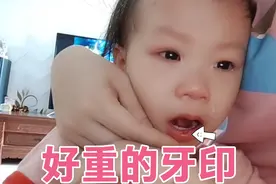 相差三岁兄妹争玩具，2岁女儿嘴唇磕出一排伤口，哭到停不下来视频封面