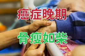 是不是所有癌症晚期的患者，最后都是骨瘦如柴，被活活地饿死吗？