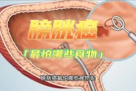 膀胱癌知识科普：膀胱癌患者最“怕”的食物有哪些？不要觉得无所视频封面