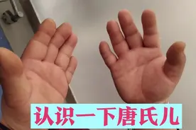 一个病房半年引产6个唐氏儿，没有产前诊断，唐宝出生率老吓人了视频封面