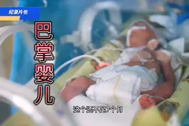 熊猫血妈妈冒着生命危险产子，男婴身体发育不全命悬一线，纪录片