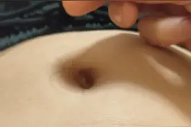 扶阳肚脐贴加上气交灸绝配视频封面