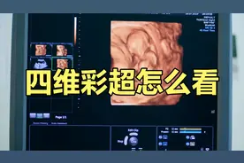 四维彩超怎么看？如果这四点你没看懂，那就是白做了！视频封面
