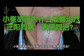 小柴胡汤为什么能够治疗三阳同病、表里同治？视频封面