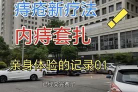 痔疮不用做手术？！内痔套扎亲身体验，5分钟做完，躺一会就回了