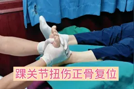 踝关节扭伤导致关节错位，疼痛肿胀，正骨复位帮你改善！视频封面
