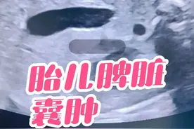 胎儿脾脏囊肿是一种较为罕见的产前超声发现，其临床意义需结合囊肿特征、伴随异常及潜在病因综合评估: 胎儿脾脏囊肿指脾脏内出现囊性结构，分为两类： 单纯性囊肿：壁薄、无分隔，内部透声好，多为良性。 复杂性囊肿：含分隔、钙化或实性成分，可能提示出血、感染或肿瘤。 临床意义: 1. 孤立性囊肿的预后    - 多数为良性，体积较小者可能自发消退（约20%-30%），出生后需超声随访。 2. 复杂性囊肿的警示    - 可能提示出血、感染或肿瘤（如血管瘤），需进一步评估。 3. 伴随畸形的风险    - 约15%-20%合并其他异常（如肾脏囊肿、心脏缺陷），需排查综合征可能，需要进一步染色体检查。 4. 脾脏功能影响    - 大囊肿可能压迫周围器官，但胎儿期罕见功能异常。 处理建议:1.产前处理#    - 定期超声监测囊肿变化，评估胎儿生长发育，合并其他发育异常，需要进一步查染色体。 2. 产后处理    - 新生儿超声确认囊肿，监测是否增大或引发症状。    - 无症状者保守观察；若囊肿增大，考虑手术切除。#医路有你 #超声影像 #医学知识科普 #每天学习一点点