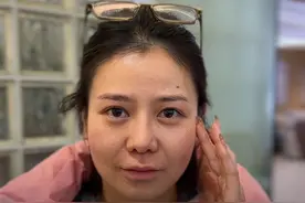 35岁女孩来拉皮 到底她做了哪些改变？一个视频讲清楚！大家觉得变化大不大？#拉皮 #抗衰老 #医学科普 #医疗健康创作训练营#抖出健康知识宝藏视频封面