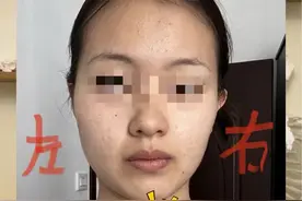 左脸大右脸小矫正训练方案来啦#大小脸 #面部不对称 #面部瑜伽 #体态纠正 #面部凹陷视频封面