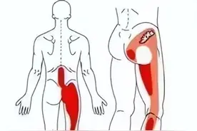 为什么腰椎间盘突出，臀部和腿会疼痛、麻木？图片