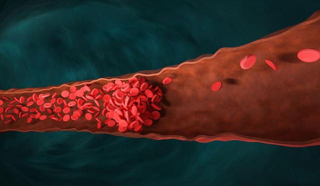 脑梗去世的人越来越多？医生劝告：天冷宁可喝凉水，也别做这3事