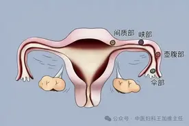 输卵管堵塞不孕，就是体内的‘垃圾’太多了，找一把小茴香就行！图片