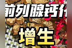 前列腺增生并钙化，7味排石化钙。图片