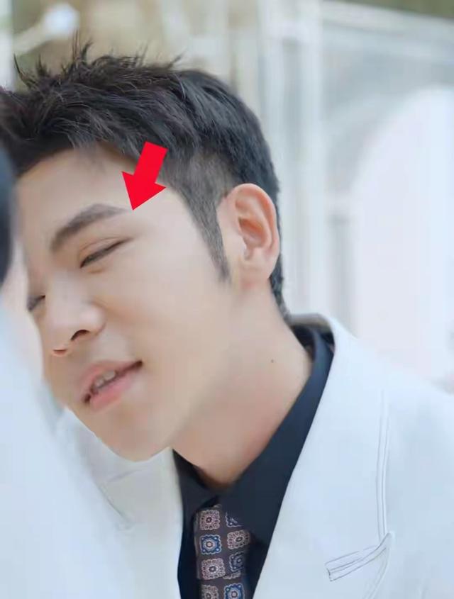 脸没恢复就别出来拍短剧，顶着膨化脸	、大刀双眼皮，太让人出戏了