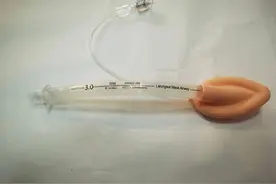 从紧张到放松：喉罩，患者的轻松伴侣图片