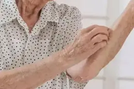 皮肤莫名痒，涂药没效果？或是4病的征兆，最好别忽视图片