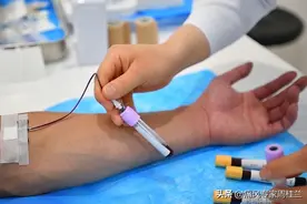 尿酸不高，痛风也发作？和这五大原因有关！痛风专家周桂兰解答！图片