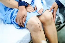 腿粗和腿细哪个更长寿？腿部的粗细真与寿命长短有关？专家这样说图片