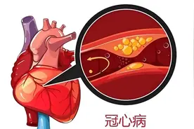 2个中成药降脂抗凝，抗动脉硬化，护心肌，抗冠心病，改善微循环图片