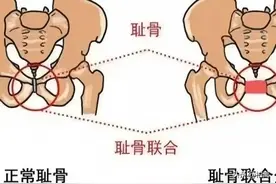 孕晚期八大「难熬时刻」，快来看看如何应对吧！图片