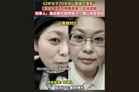42岁“断崖式衰老”上热搜！专家：较少见，但这些是早衰常见症状 | 第医线图片