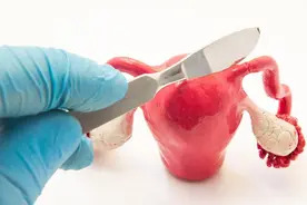 子宫切除后，会给身体带来哪些影响？提醒：心态很重要图片