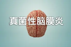 “脑干出血有多恐怖”？为自己和家人，建议多了解点脑部健康吧图片