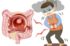 一碗散结汤，祛息肉不手软，不仅软坚散结，还能对抗复发！图片