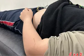 记者探访“儿童肥胖门诊”：最小患者不足3岁，已胖出脂肪肝图片