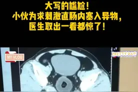 肛肠科的趣事，真是一个比一个有意思图片