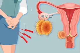 淋病：性传播疾病的隐形杀手，了解这些并发症刻不容缓！图片