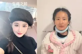98年女生确诊渐冻症一年容貌巨变，吞咽都要尽全力图片
