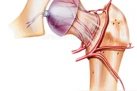 股骨头坏死的常见症状，医生帮你讲明白图片