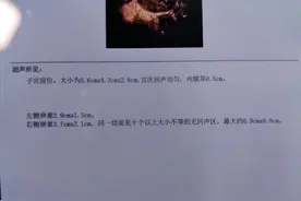 怀孕8周，孕吐到达顶峰，吃啥都吐！卵巢查出囊肿！真让人崩溃图片