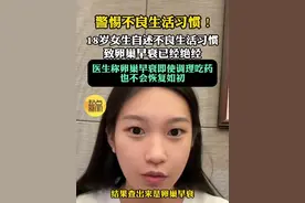 18岁女生自述卵巢早衰已绝经！晚睡早起 吃饭重油重辣…… 近日，河南一位18岁的女生，在社交平台分享了自己确诊卵巢早衰的经历，自述得病与不良生活习惯息息相关。长期凌晨三点睡觉、晚睡早起、 节食减肥、放纵餐又重油重辣导致身体逐渐出现反应。随后女生前往当地医院检查，#医生称卵巢早衰调理后也不会恢复如初#。起点新闻编辑查询资料了解到，卵巢早衰主要与遗传因素、不良生活习惯和长期处于负面情绪中等因素有关。南京市妇幼保健院内分泌科主任陈捷提醒：卵巢功能衰退不可逆，女性平日应注意作息规律、戒烟限酒、多吃新鲜果蔬、“久坐党”要多运动，如发现身体异常及时就诊。（编辑：罗雪）
