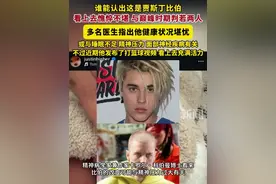 多名医生指出30岁的贾斯丁比伯健康状况堪忧，或与睡眠不足、精神压力大及面部神经疾病有关。不过近期他发布了打篮球视频，看上去充满活力。#贾斯丁比伯视频封面