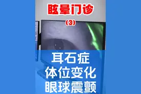 耳石症，导致眼球震颤，所以天旋地转，甚至呕吐  #耳石症 #席刚明 #硬核健康科普行动  #医学科普视频封面