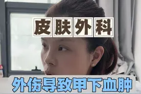 外伤导致的甲下血肿，什么情况下需要拔甲 #甲下出血 #甲下淤血 #拔甲 #皮肤外科 #医学科普视频封面