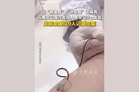 6月17日报道，#云南检出一例小p血型比熊猫血还稀有  ，此前全国仅9人记录在案。视频封面
