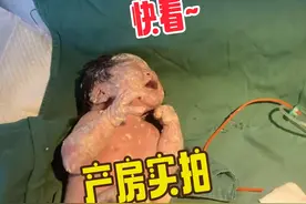 见过新生儿出生时身上有胎脂的，可没见过这么多的 #产房视频封面