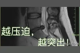 腰椎间盘突出根源其实不在腰，问题出在这里图片