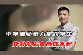 中学老师暴力体罚学生，致其臀部淤青卧床不起？教体局官方回应视频封面