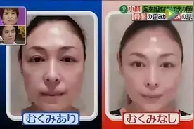 「跷二郎腿」的一个意外伤害：脸变大图片